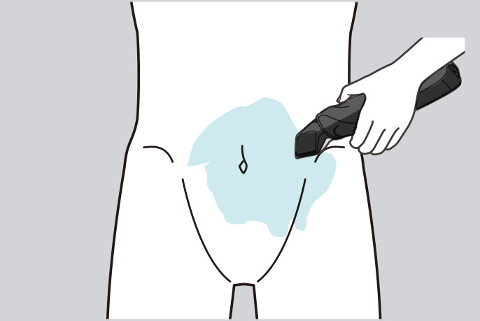 イメージ図：水、せっけんなどをつけた個所を剃る