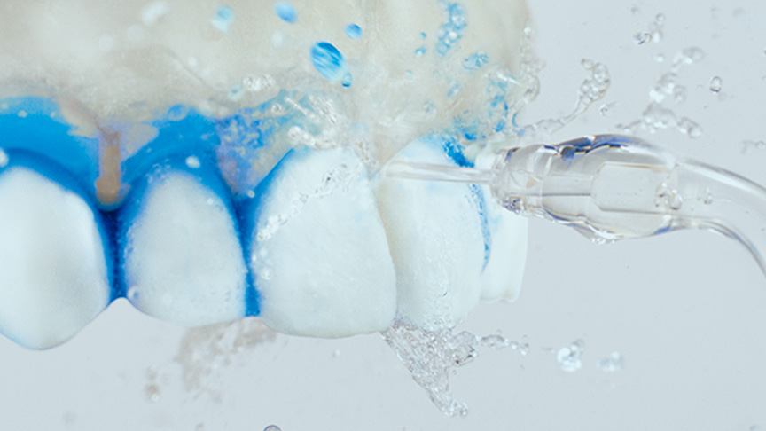 写真：歯周ポケット内の見えない汚れや、ブラッシングによって歯周ポケット内に剥がれ落ちた歯垢までしっかり洗い流すイメージ