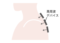 高周波デバイス