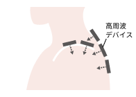 高周波デバイス