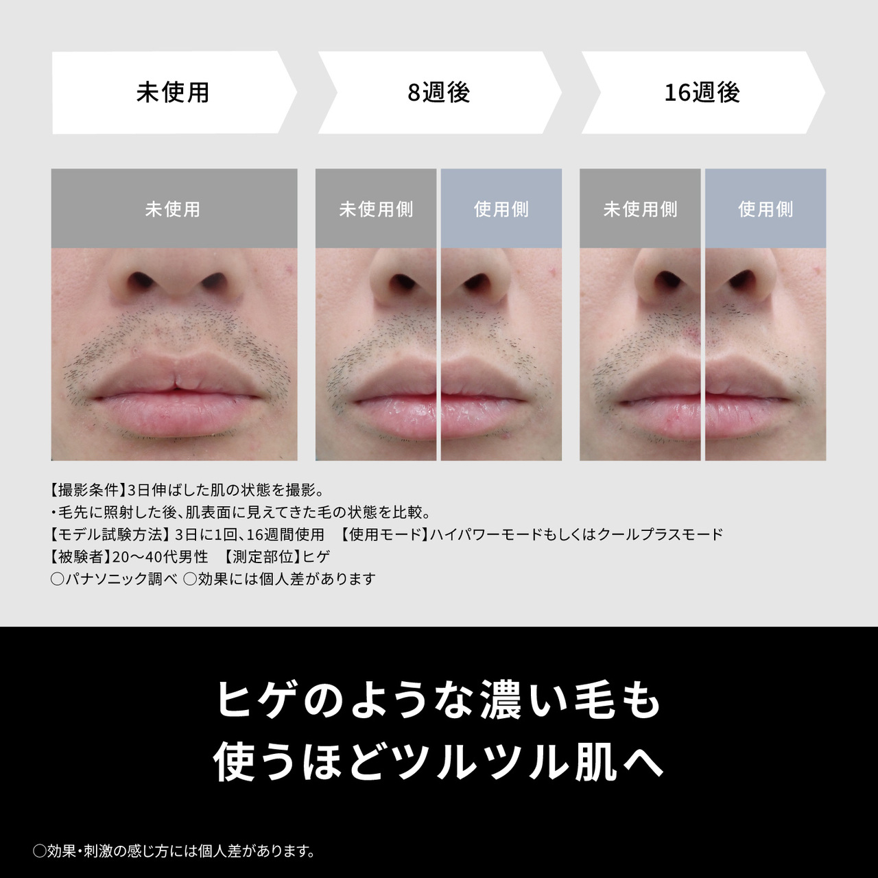 ヒゲのような濃い毛も　使うほどツルツル肌へ　使用前　使用後　【被験者】20～40代男性　【測定部位】ヒゲ　【撮影条件】パワーモードで使用後の状態を撮影　○パナソニック調べ　○効果・刺激の感じ方には個人差があります