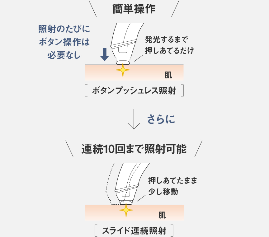 ［ボタンプッシュレス照射］カンタン操作。発光するまで押しあてるだけ。照射のたびにボタン操作は必要なし。,［スライド連続照射］連続10回まで照射可能。押しあてたまま少し移動。