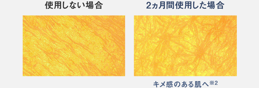 肌の写真：左は使用しない場合、右は2か月間使用した場合。キメ感がある
