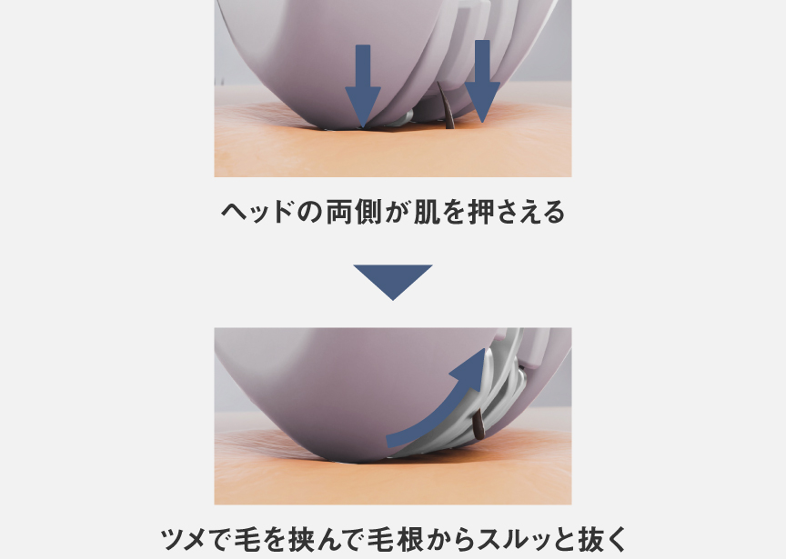 ヘッドの両側が肌を押さえる→ツメで毛を挟んで毛根からスルッと抜く