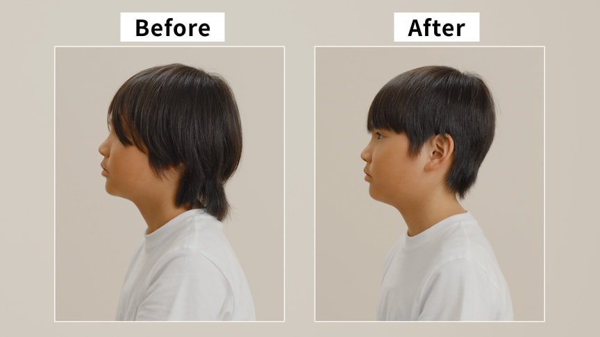 写真：Before After 横向きのヘアスタイルを左右で比較した様子