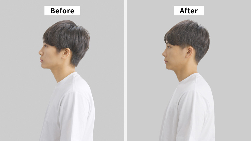 写真：Before After ヘアカット前後の比較