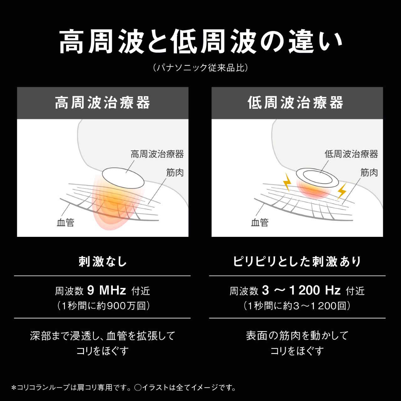 高周波と低周波の違い（パナソニック従来品比） 高周波治療器 高周波治療器 筋肉 血管 刺激なし 周波数9MHz付近（1秒間に約900万回） 深部まで浸透し、血管を拡張してコリをほぐす 低周波治療器 低周波治療器 筋肉 血管 ピリピリとした刺激あり 周波数3～1200Hz付近（1秒間に約3～1200回） 表面の筋肉を動かしてコリをほぐす ＊コリコランループは肩コリ専用です。○イラストは全てイメージです。