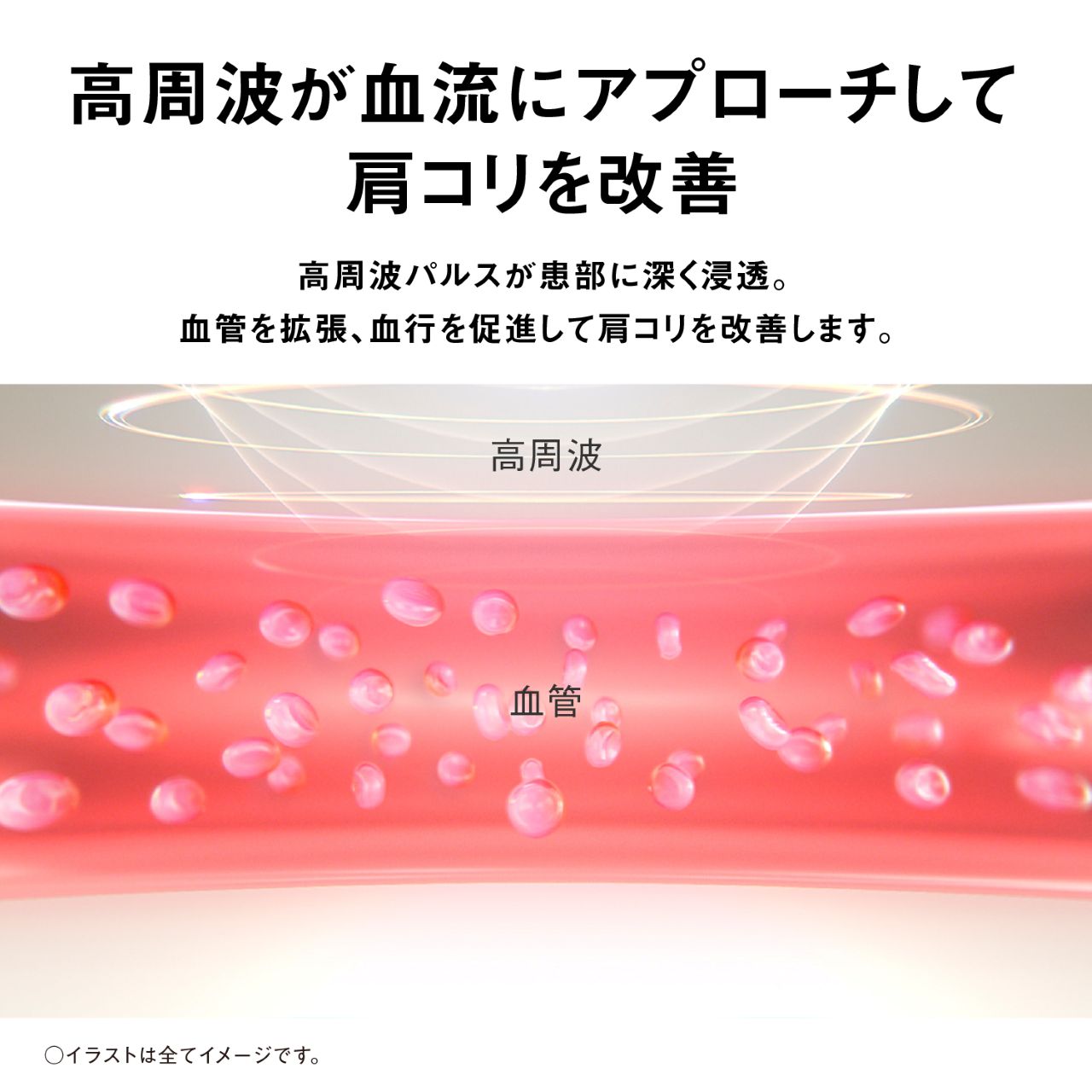 高周波が血流にアプローチして肩コリを改善 高周波パルスが患部に深く浸透。血管を拡張、血行を促進して肩コリを改善します。 高周波 血管 ○イラストは全てイメージです。