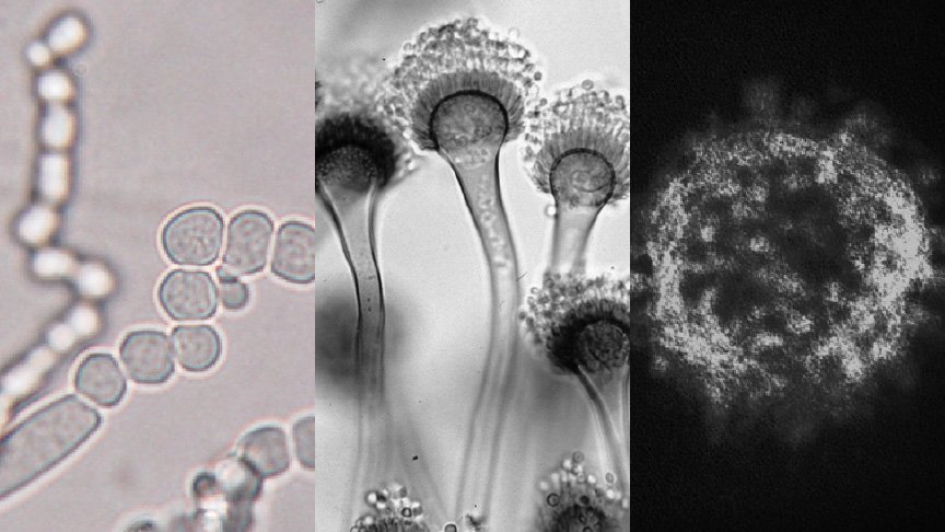 ウイルス・カビ菌・菌