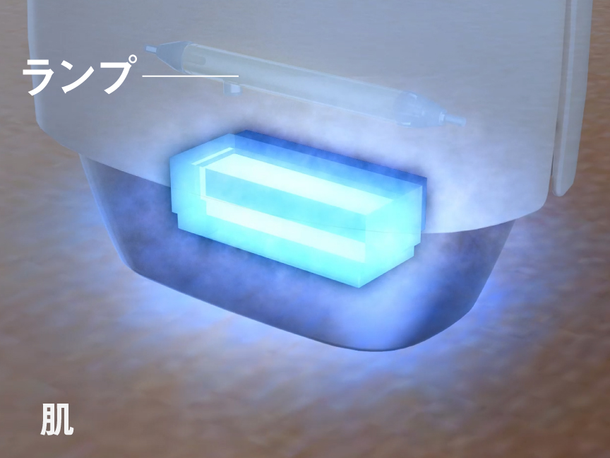 イメージ：肌に直接ランプが触れない安心設計