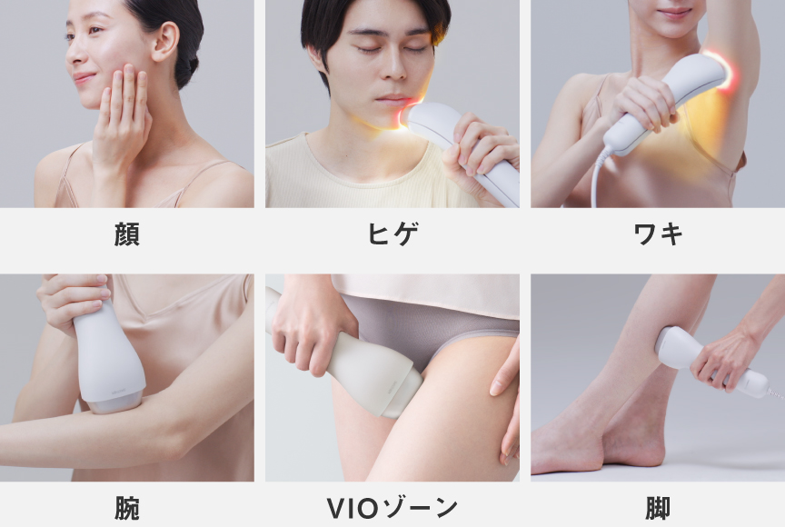 身体の部位の写真：顔・ヒゲ、ワキ、腕、VIOゾーン、脚