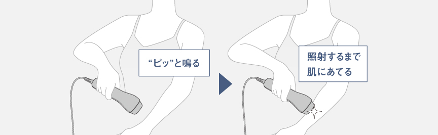 イラスト：腕に光エステを当てているイメージ