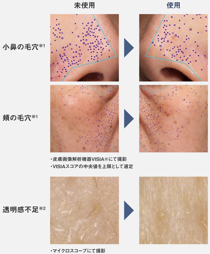 未使用と使用8週間の比較写真：小鼻の毛穴、毛穴目立ち、透明感不足