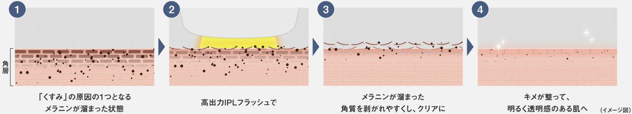 イメージ図：「くすみ」の原因の1つとなる メラニンが溜まった角質→美肌IPL技術で→メラニンが溜まった角質を剥がれやすくし→キメが整って、明るく透明感のある肌へ