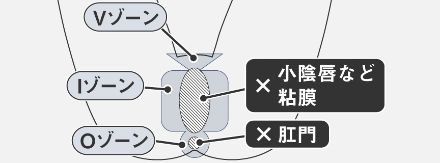 イラスト：使用できる部位の説明 Vゾーン、Iゾーン、Oゾーン。小陰唇など粘膜、肛門は使用不可。