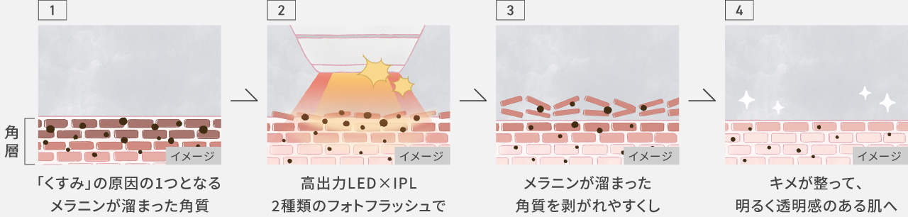 イラスト：「くすみ」の原因の1つとなるメラニンが溜まった角質→高出力LED×IPL 2種類のフォトフラッシュで→メラニンが溜まった角質を剥がれやすくし→キメが整って、明るく透明感のある肌へ
