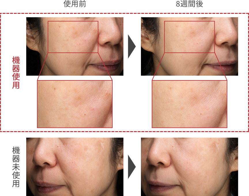 写真：肌の明るさ比較 使用前に比べ使用8週間後の方が肌の明るさがアップ