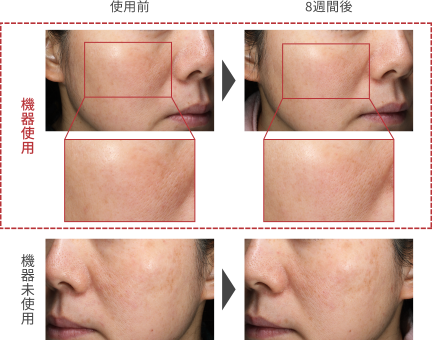 写真：肌の明るさ比較 使用前に比べ使用8週間後の方が肌の明るさがアップ