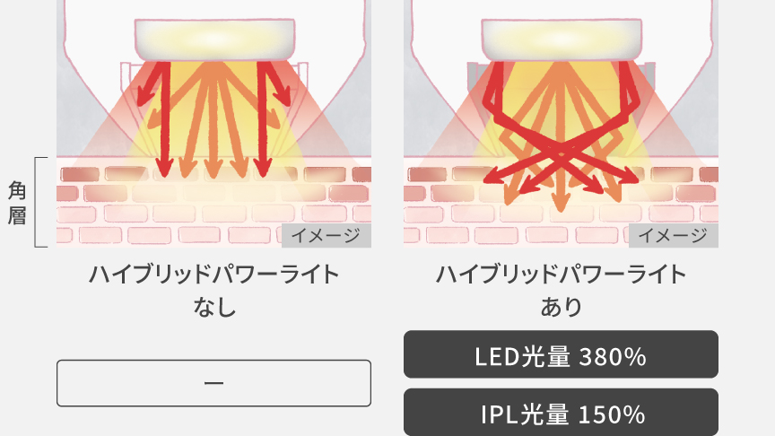 集光イメージイラスト：ハイブリットパワーライトありだとLED光量380％、IPL光量150％