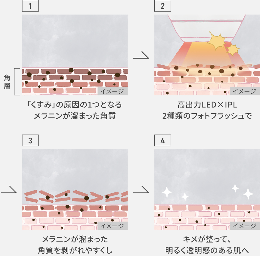 イラスト：（１）「くすみ」の原因の1つとなるメラニンが溜まった角質,（２）高出力LED×IPL 2種類のフォトフラッシュで,（３）メラニンが溜まった角質を剝がれやすくし,（４）キメが整って、明るく透明感のある肌へ