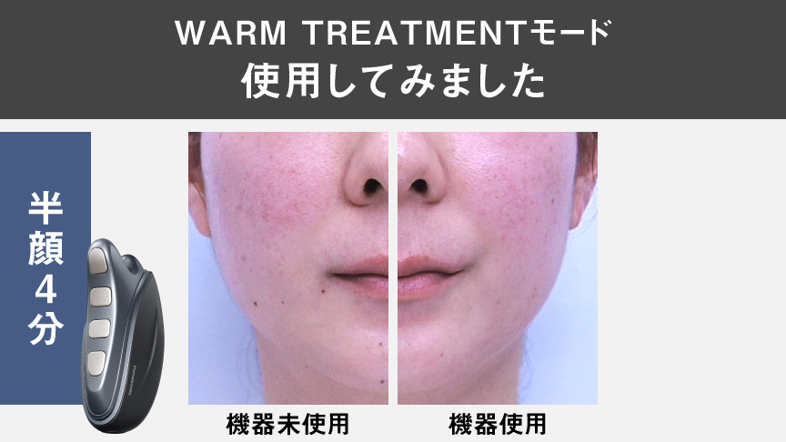 写真：WARM TREATMENTモードを使用した際の比較