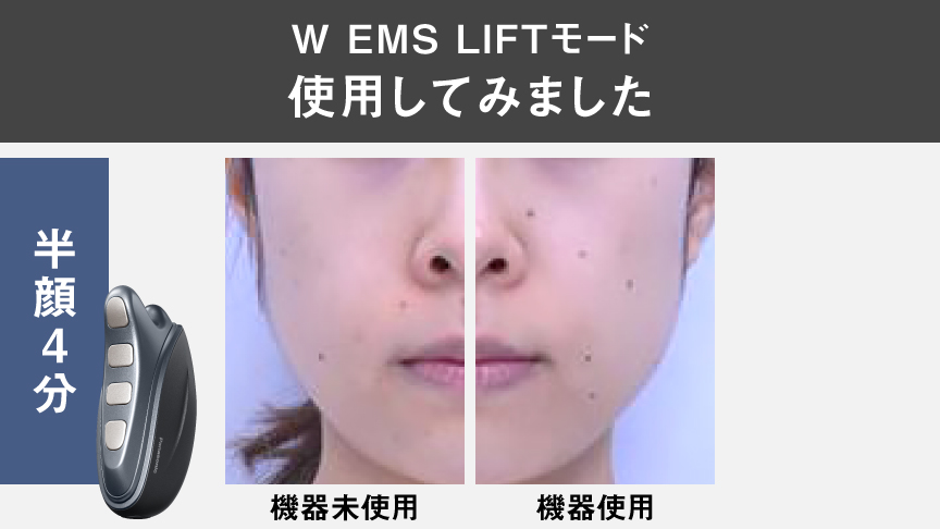 写真：W EMS LIFTモードを使用した際の比較