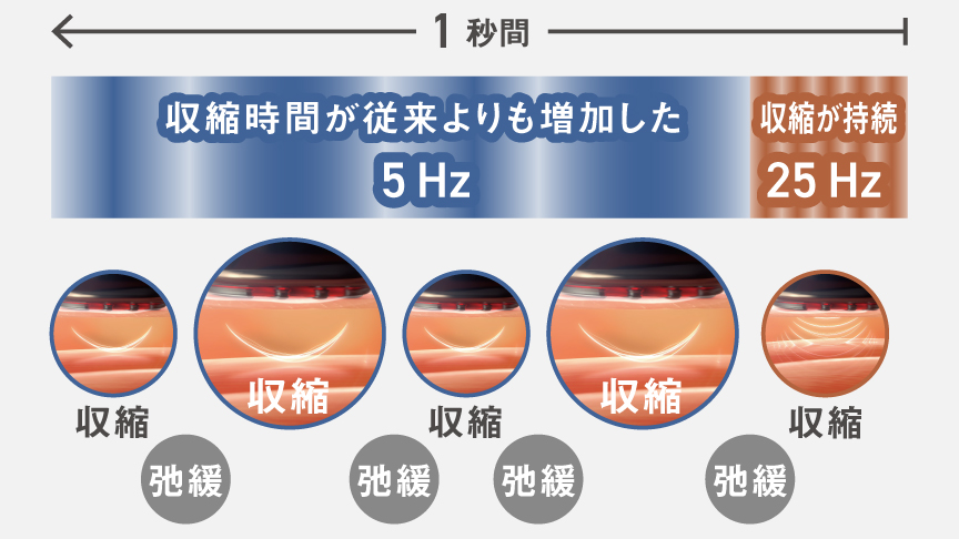 収縮時間が従来よりも増加した5 Hz,収縮が持続 25 Hz