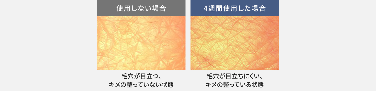 比較写真：使用しない場合（毛穴が目立つ、キメ感の整っていない状態）,4週間使用した場合（毛穴が目立ちにくい、キメ感の整っている状態）
