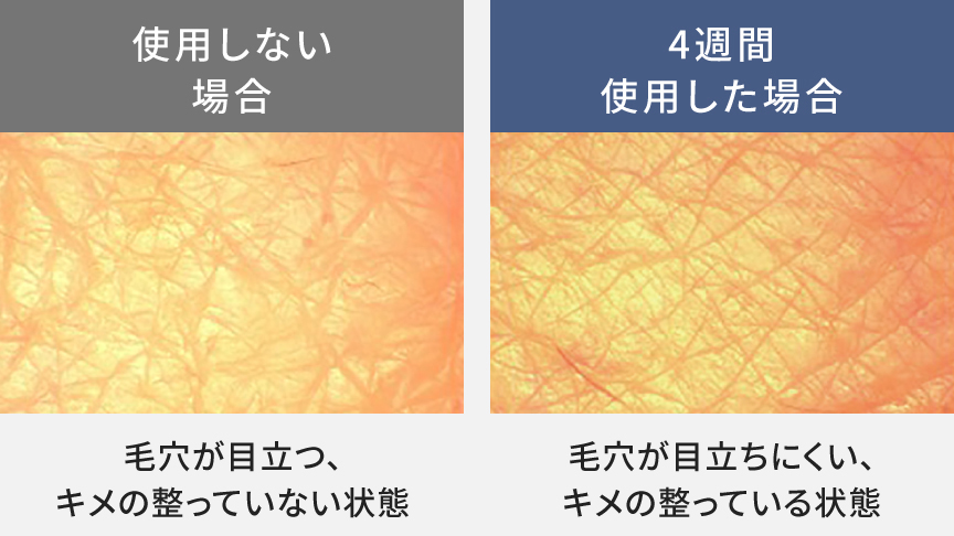 比較写真：使用しない場合（毛穴が目立つ、キメ感の整っていない状態）,4週間使用した場合（毛穴が目立ちにくい、キメ感の整っている状態）