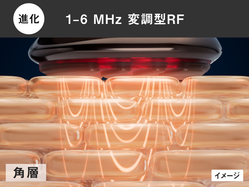 進化：1 - 6 MHz 変調型RF