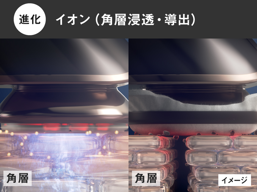 進化：イオン（角層浸透・導出）