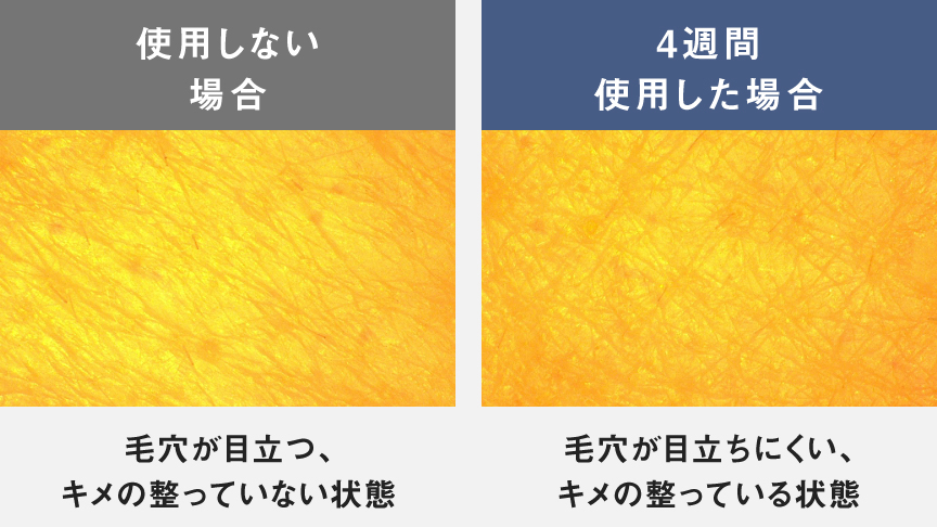 比較写真：使用しない場合（毛穴が目立つ、キメの整っていない状態）,4週間使用した場合（毛穴が目立ちにくい、キメの整っている状態）