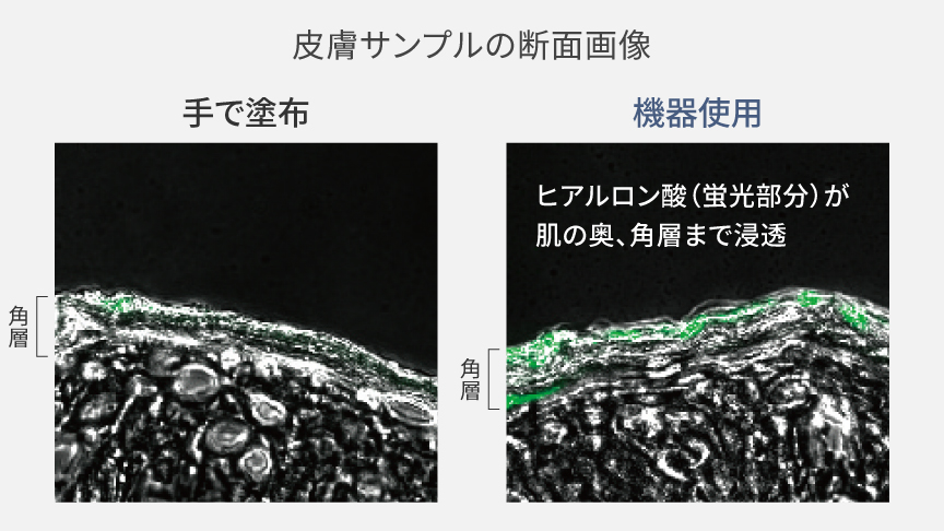 皮膚サンプルの断面画像：手塗りと機器使用の比較