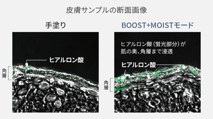 皮膚サンプルの断面画像：手塗りとB00ST＋MOISTモードの比較