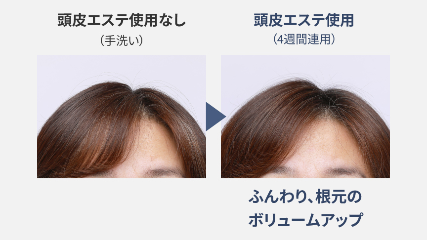 頭皮エステ使用なし（手洗い）と頭皮エステ4週間連用の比較写真。頭皮エステ使用後ではふんわり、根元のボリュームアップ