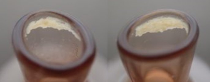 （写真左）毛穴吸引 スポットクリア のみでケア （写真右）スチーマー ナノケア と併用