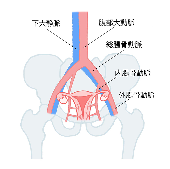 図：骨盤内にある血管や自律神経の説明 下大静脈、腹部大動脈、総腸骨動脈、内腸骨動脈、外腸骨動脈
