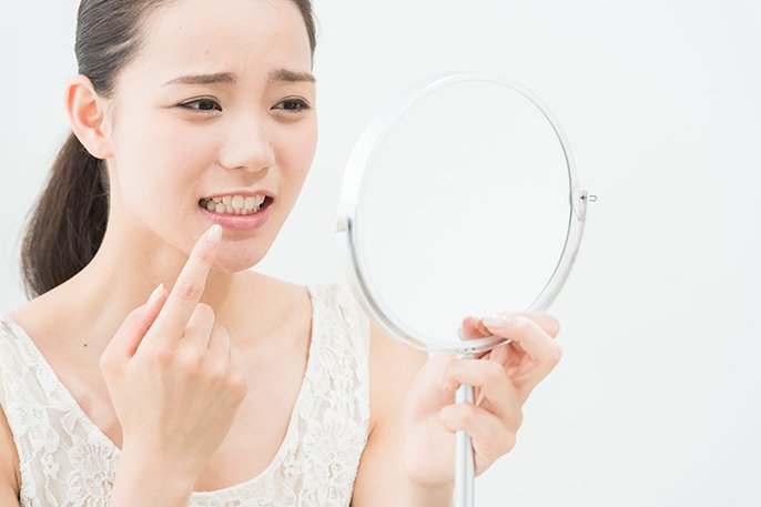 写真：鏡で歯茎を見る女性