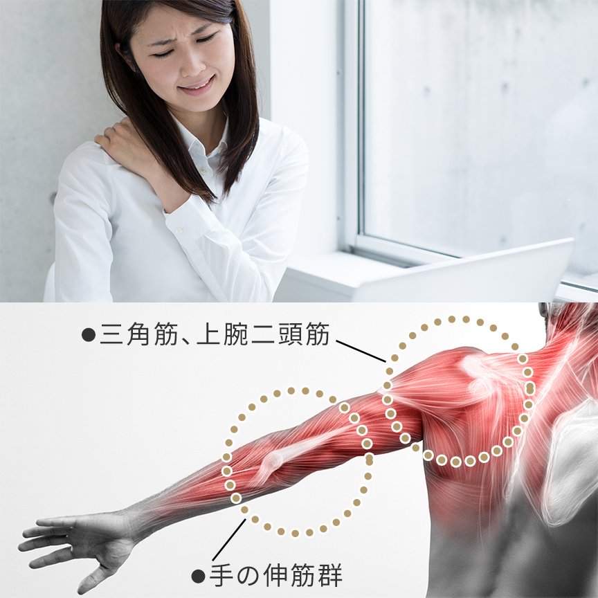左側：写真：女性が左肩に手を添えて、痛そうな顔をしている様子 右側：イラスト：●三角筋、上腕二頭筋 ●手の伸筋群の場所を記しているイラスト