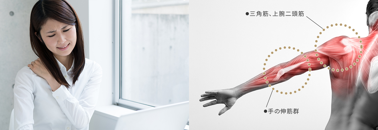 左側：写真：女性が左肩に手を添えて、痛そうな顔をしている様子 右側：イラスト：●三角筋、上腕二頭筋 ●手の伸筋群の場所を記しているイラスト