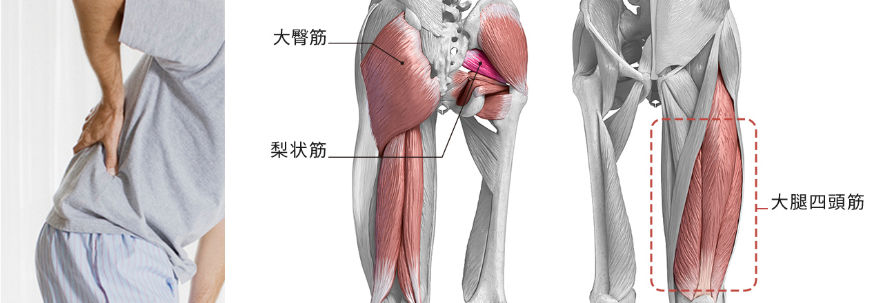 左側写真：右手で曲がった腰を抑えている様子 右側：大臀筋 梨状筋 大腿四頭筋 の場所を記したイラスト