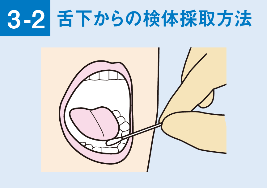 舌下部に滅菌綿棒を10秒間静置し、唾液を滅菌綿棒に吸収させます