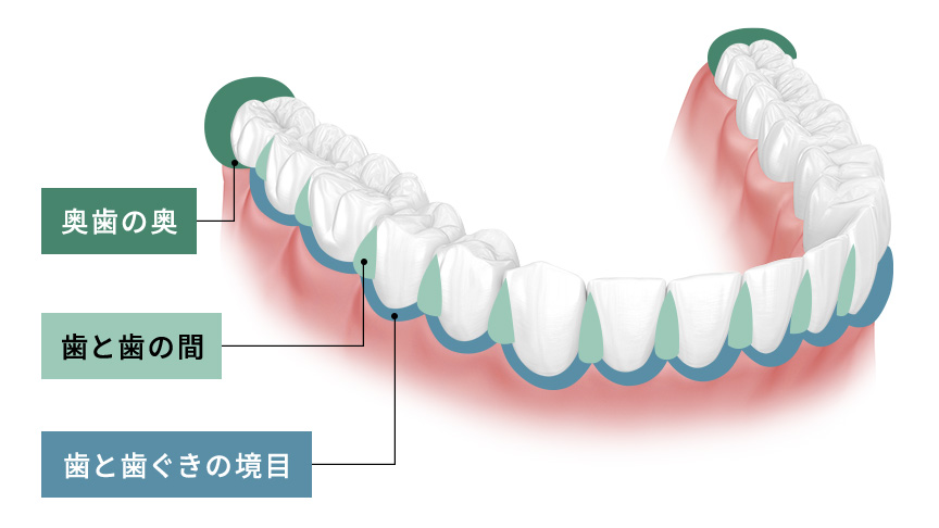 磨き残しが多い部位（奥歯の奥、歯と歯の間、歯と歯ぐきの境目）のイラスト