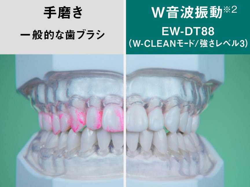 手磨き　VS　W音波振動
