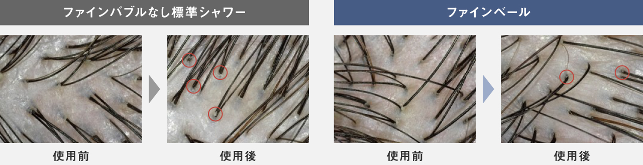 ファインバブルなし 標準シャワーとファインベール ヘアケアモードの頭皮の比較