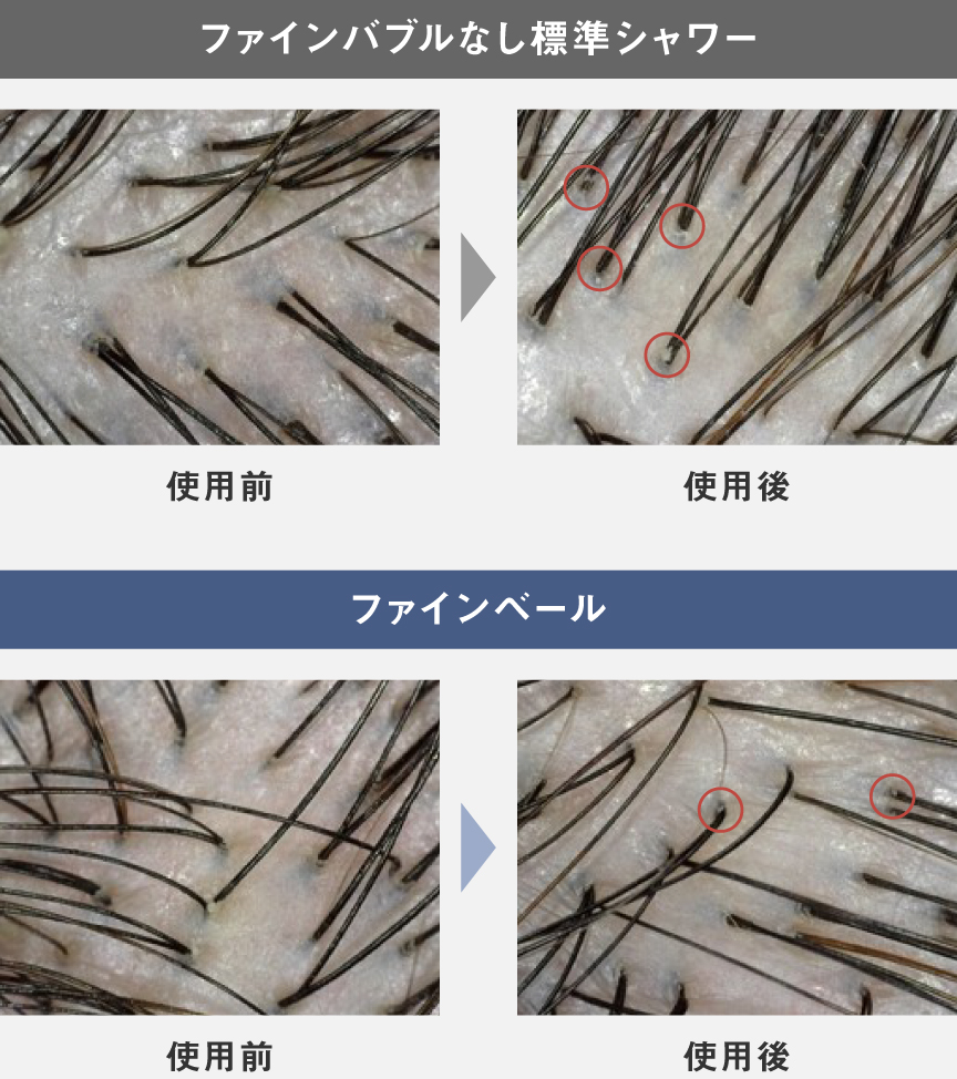 ファインバブルなし 標準シャワーとファインベール ヘアケアモードの頭皮の比較
