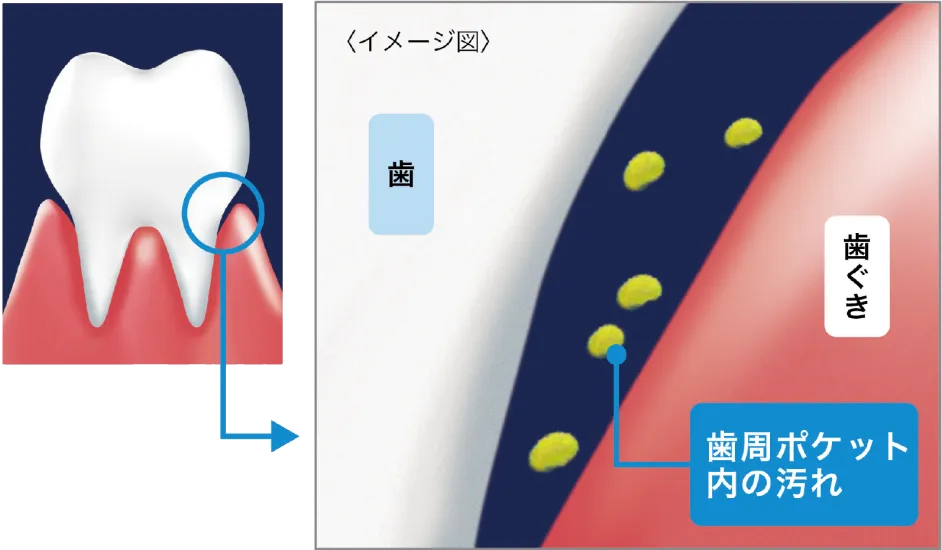 約3日で歯ぐきの健康を推進
