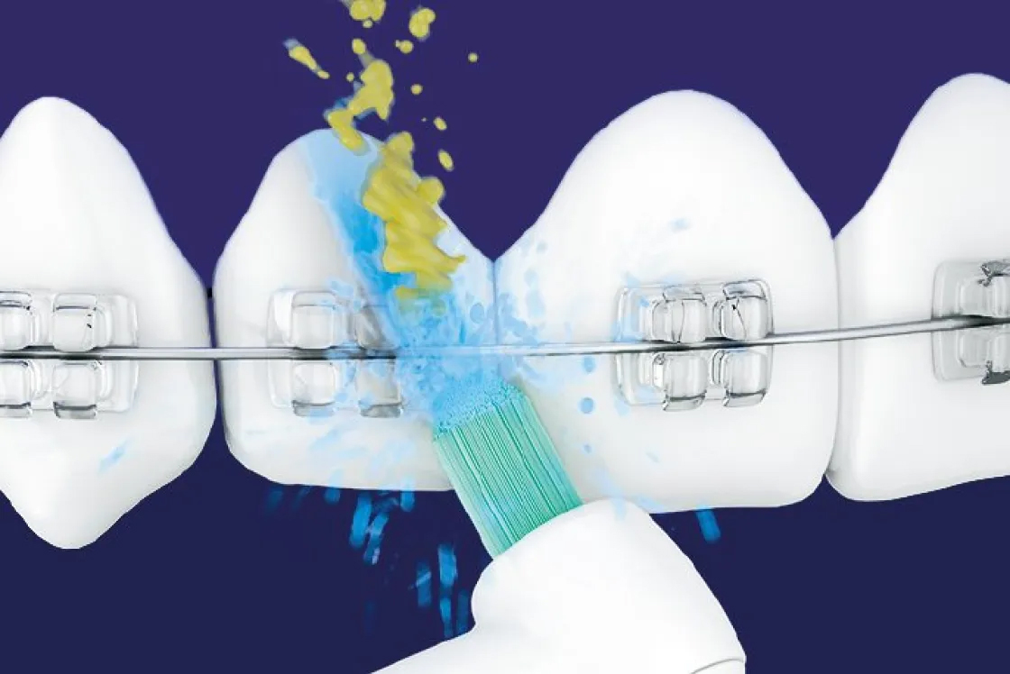 超音波水流ノズル