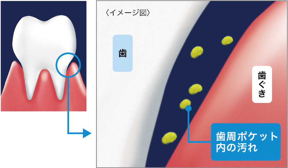 画像：約3日で歯ぐきの健康を推進