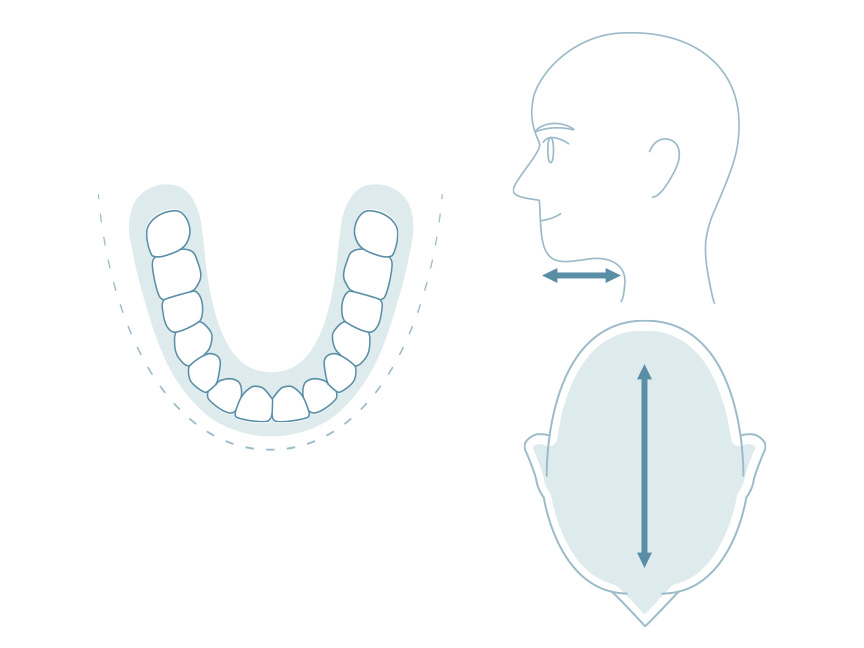 欧米人の頭部と歯のイメージ